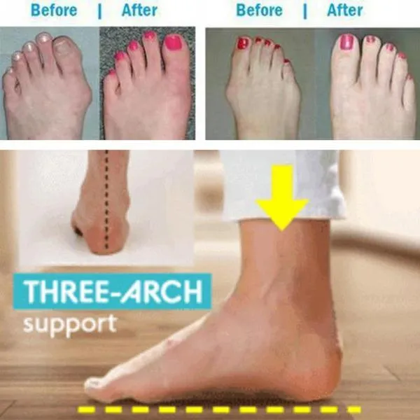 BESTWALK Orthopedic Premium Toe Corrector Bunion Comfy Foot Sandals